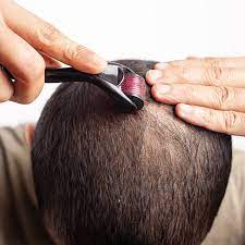 Derma Roller