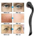 Derma Roller